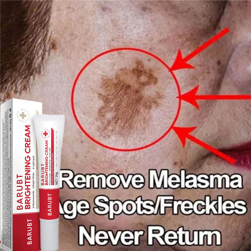 Skincare Vitamin C - Potente Crema Sbiancante Rimuovi-Macchie, Illumina Rapidamente