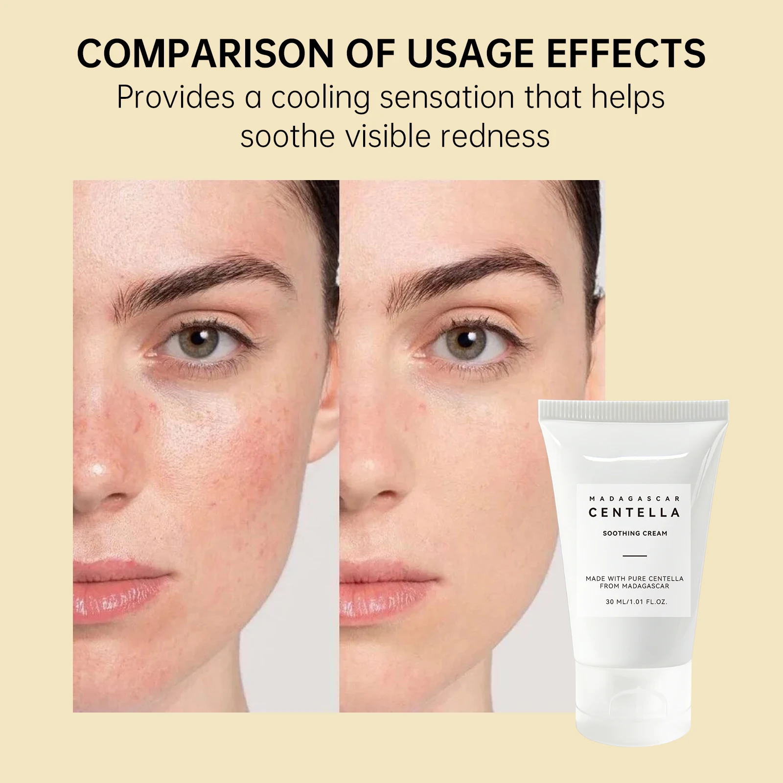 Gel Lenitivo alla Centella Asi - Skincare Centella recensione e prezzo