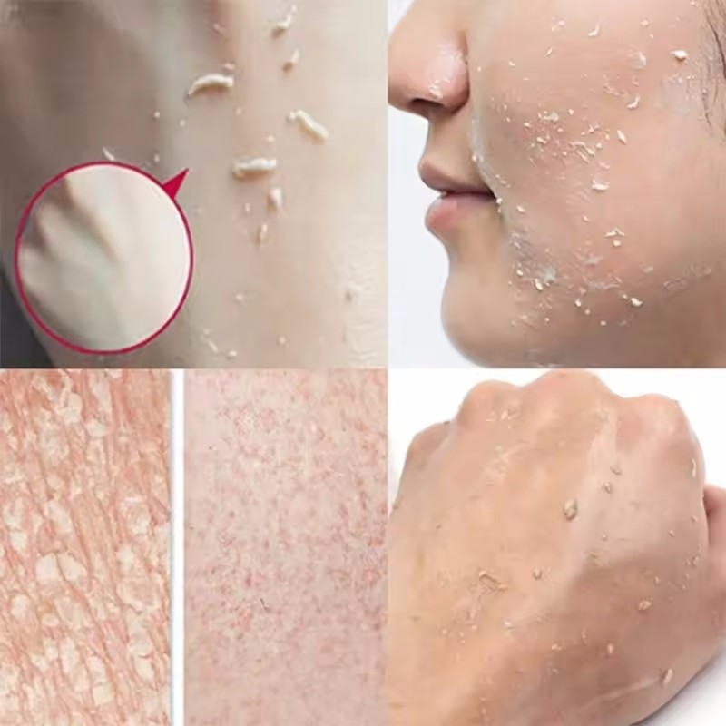 Gel peeling esfoliante arancio - Ceramide Moisturizer recensione e prezzo